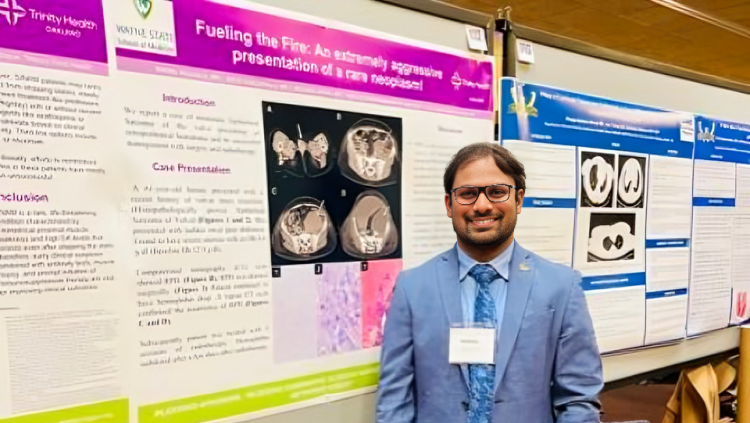 Bosutinib-Induced Pleural Effusion—Class Effect and Cross-Intolerance to All Tyrosine Kinase Inhibitors by Nikhil Vojjala et al
