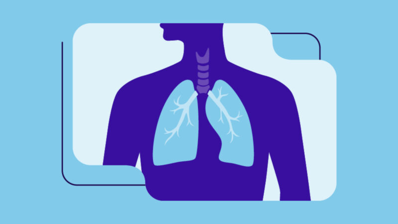 Evolving field of immunotherapy: pioneering new paths in SCLC by Antonious Ziad Hazim et al