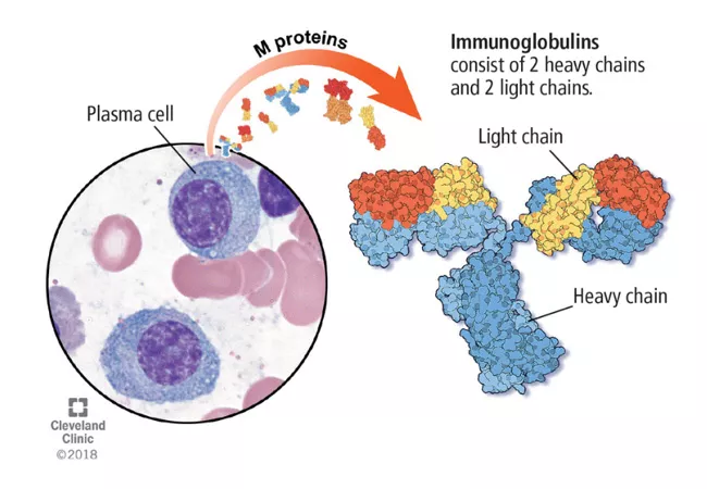 abnormal monoclonal proteins