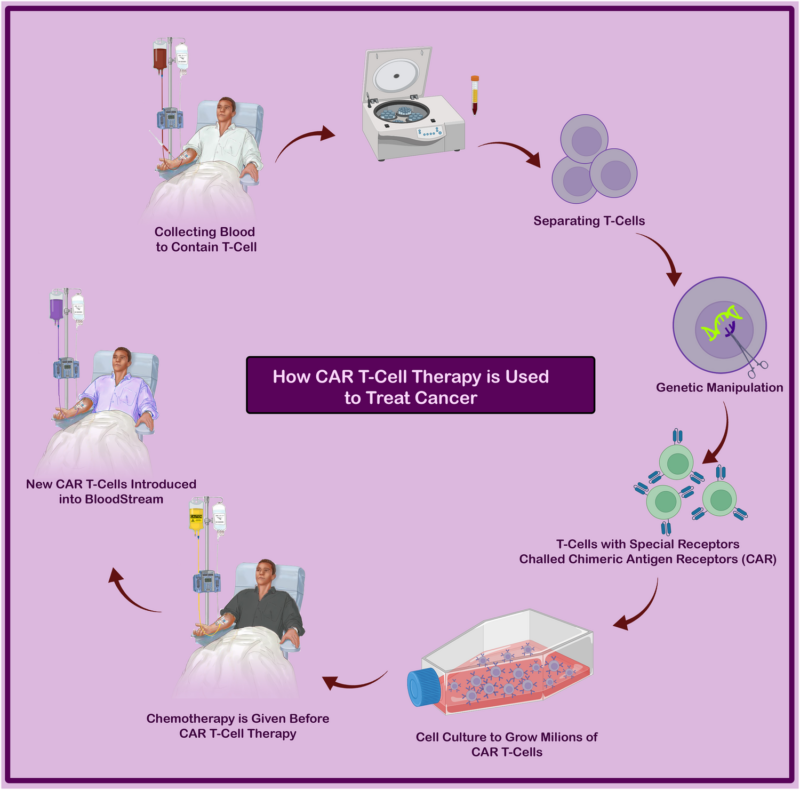 CAR T-Cell Therapy for Multiple Myeloma