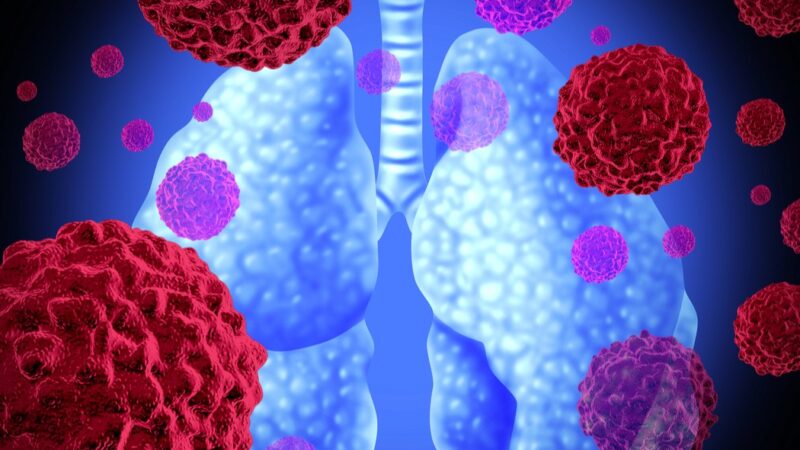 Aakash Desai Shared PLAN Study on Plasma-First NGS in Advanced NSCLC
