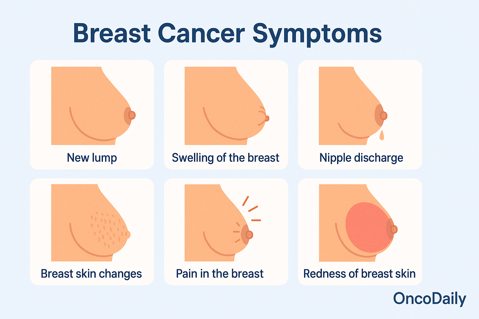 breast cancer symptoms