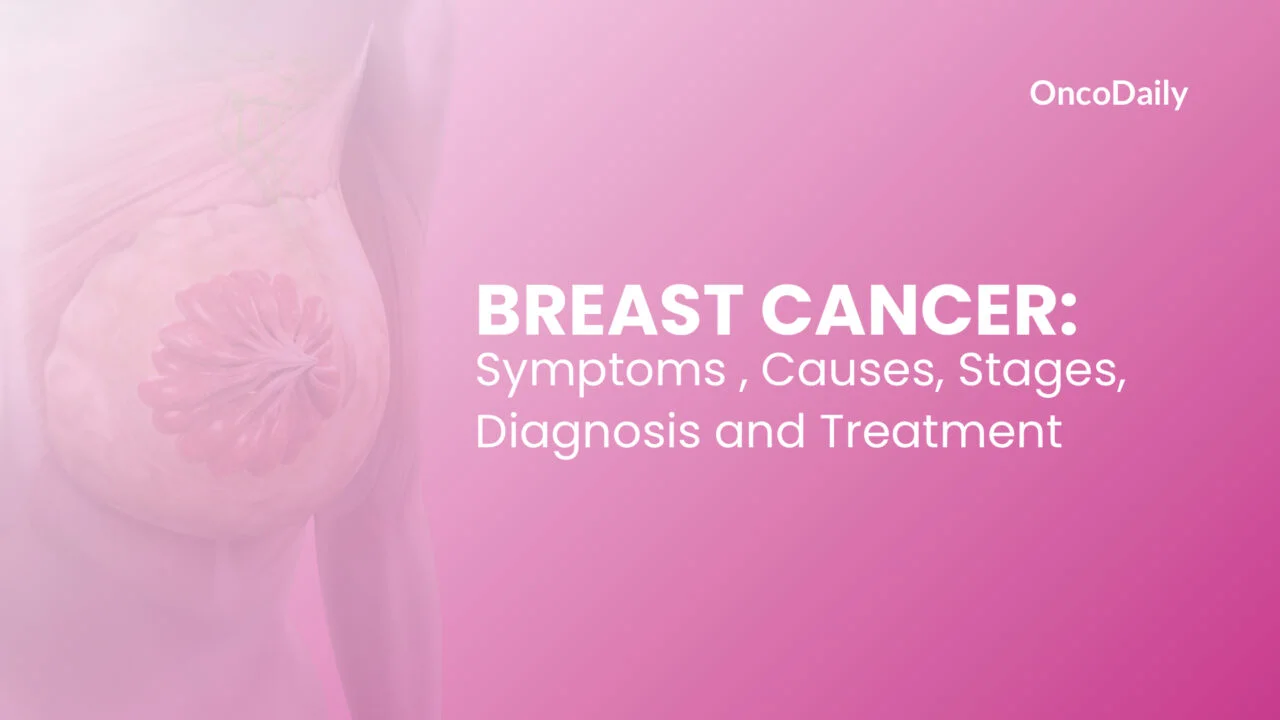 Breast Cancer