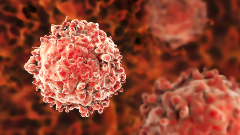 Novel mechanisms of resistance in Chronic lymphocytic leukemia – Blood Journal