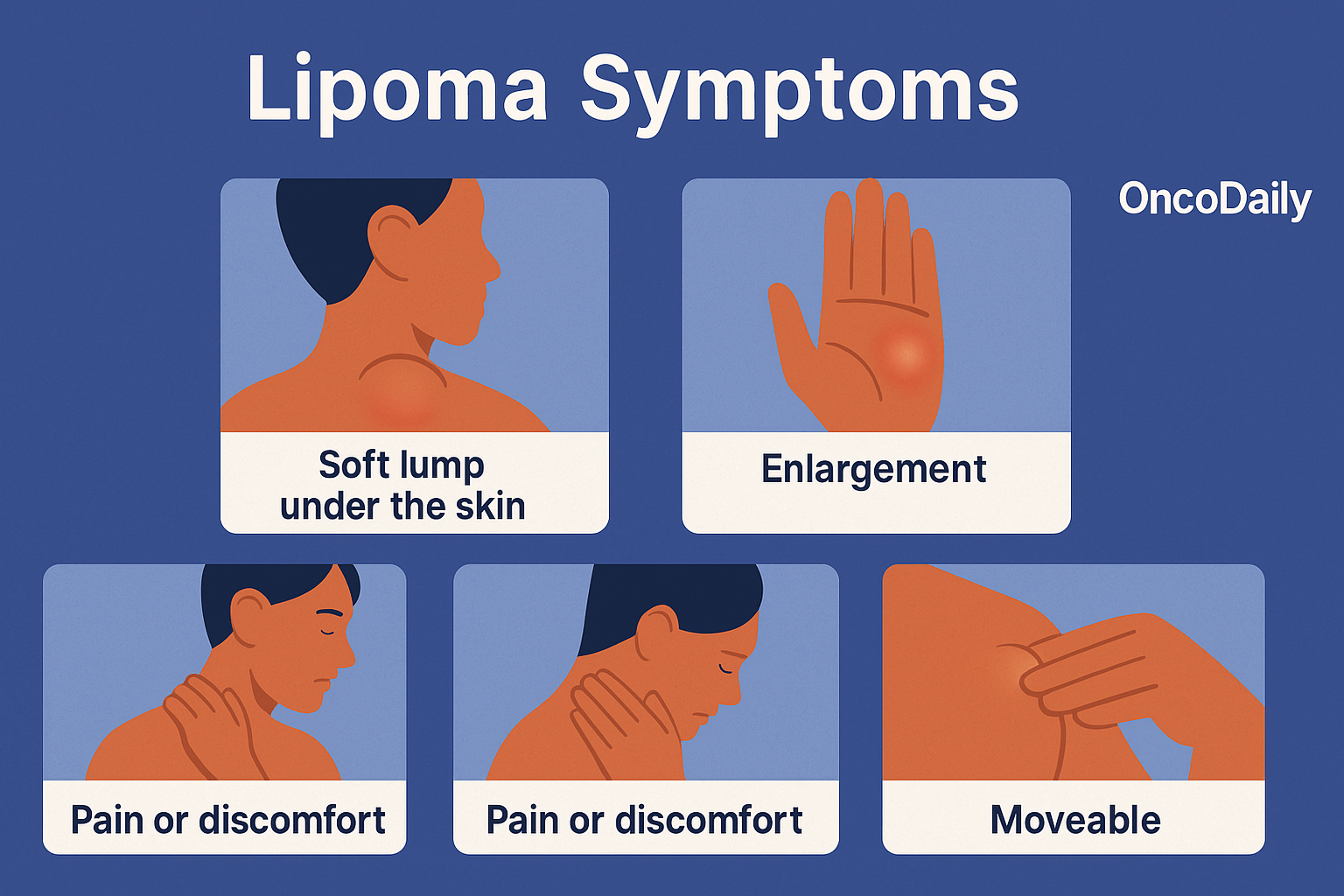 lipoma symptoms oncodaily