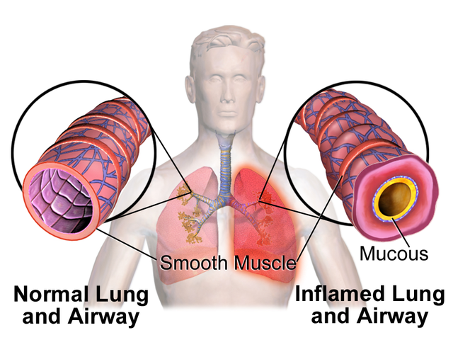 does vaping cause cancer