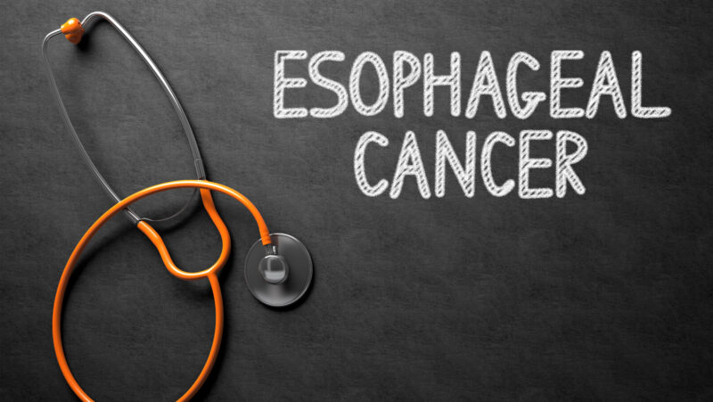 Single-cell multi-stage spatial evolutional map of esophageal carcinogenesis