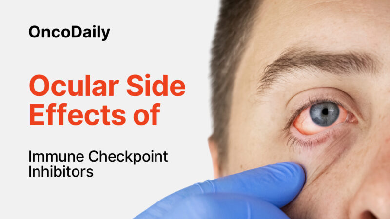 Ocular Side Effects Of Immune Checkpoint Inhibitors