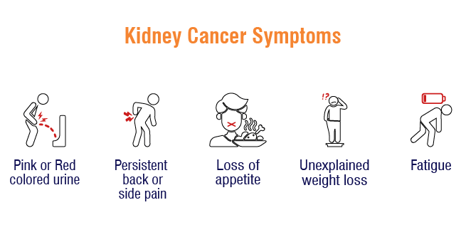 Symptoms of Kidney Cancer