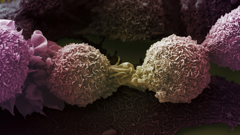 Avoiding, rewiring and turning AI on cancer – CRUK