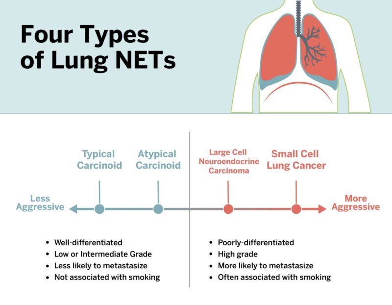 Neuroendocrine-lung-tumors