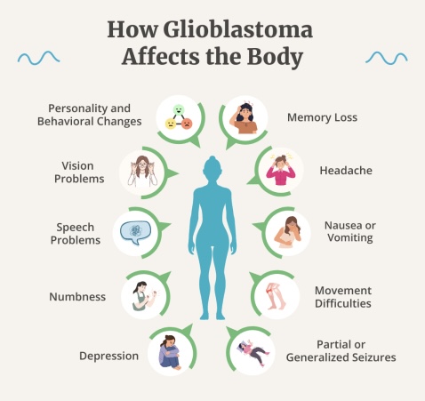 glioblastoma