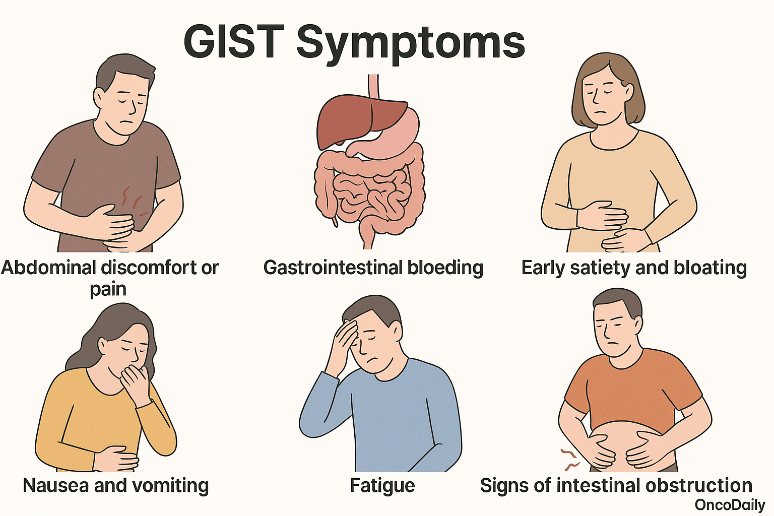 GIST symptoms