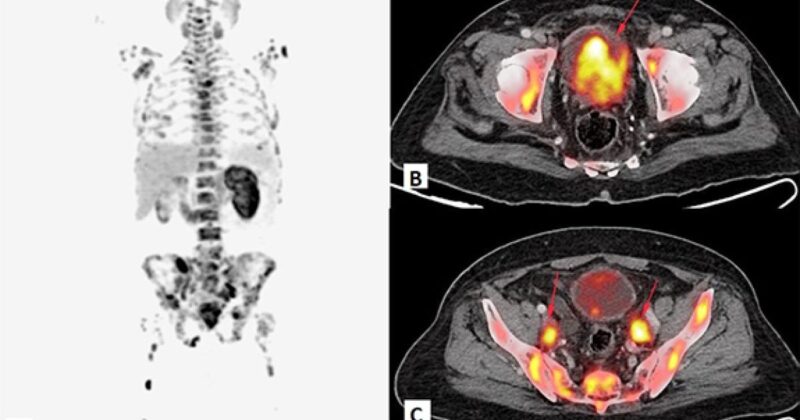 Gustavo Viani: When is the Best Time to Scan?