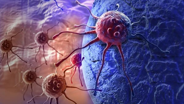 Molecular Hyperselection for Optimal First-Line Targeted Therapy in RAS Wild-Type Metastatic Colorectal Cancer