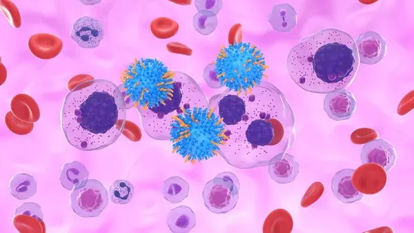 CD38-Based Quadruplets Take Center Stage in New Practice-Changing Myeloma Guidelines