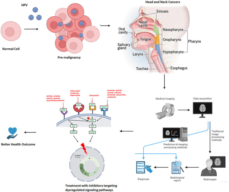 Head and Neck Cancer