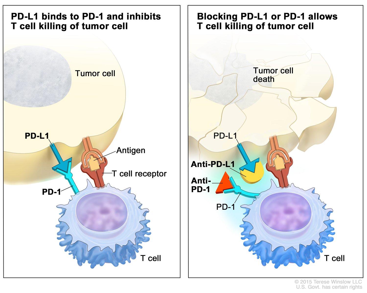 immunotherapy for skin cancer 