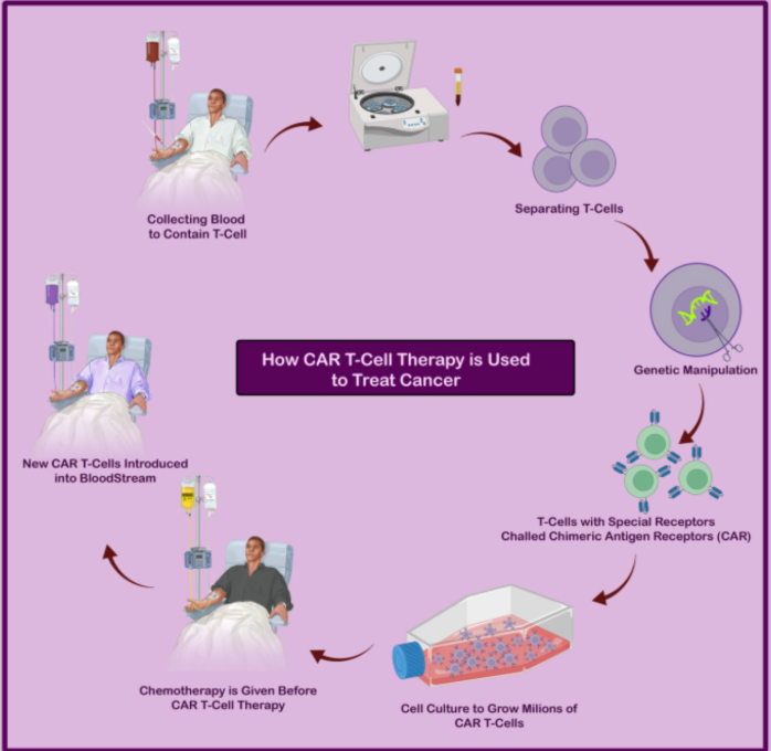 Ocular Side Effects Of CAR-T Cell Therapy
