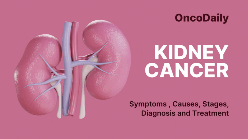 Kidney Cancer
