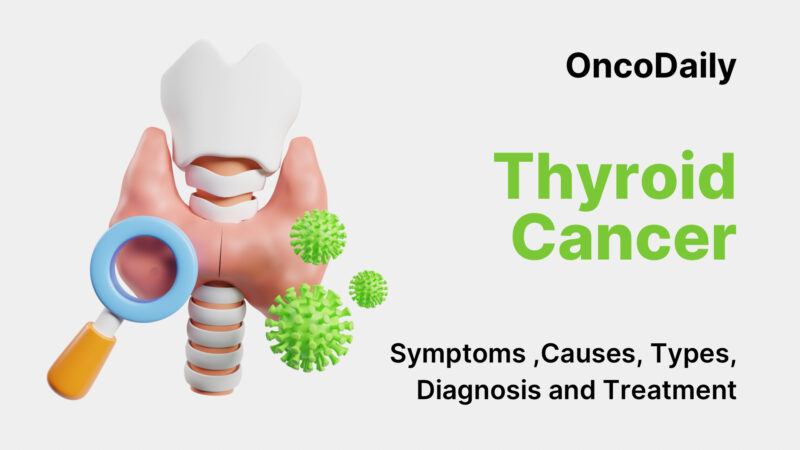 Thyroid Cancer: Symptoms, Causes, Stages, Diagnosis, and Treatment