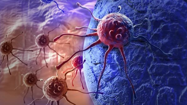 Vivek Subbiah: Resolution of Squamous-Cell Carcinoma by Restoring T-Cell Receptor Signaling