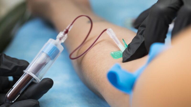 Cancers can be detected in blood 3 years prior to diagnosis – Lung Cancer Europe