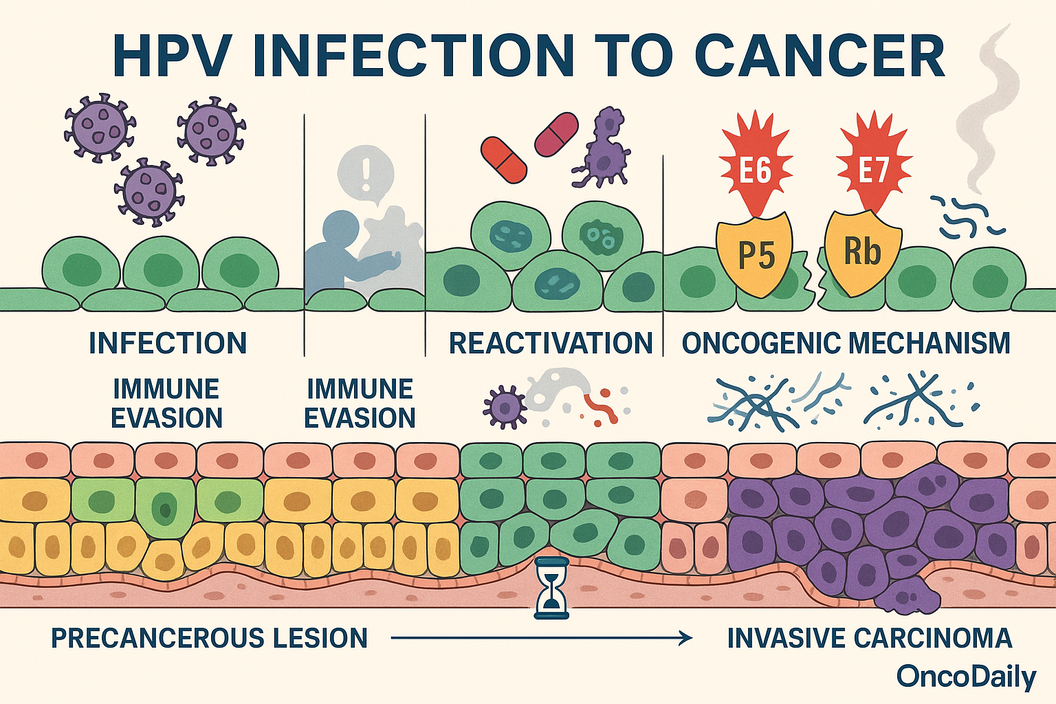HPV and Cancer AT
