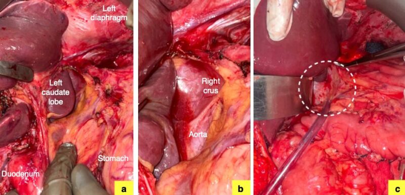 Aditi Bhatt Surgical Intervenions