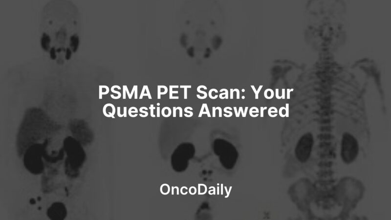 PSMA PET Scan: Your Questions Answered