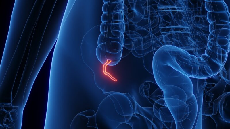 ASCRS Clinical Practice Guidelines on the Management of Appendiceal Neoplasms – DCR Journal
