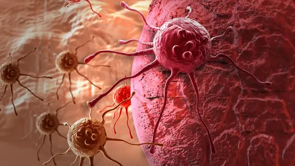 Mazyar Shadman: Real-World Treatment Patterns in DLBCL