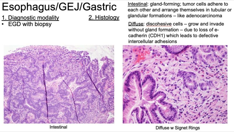 GI Pathology