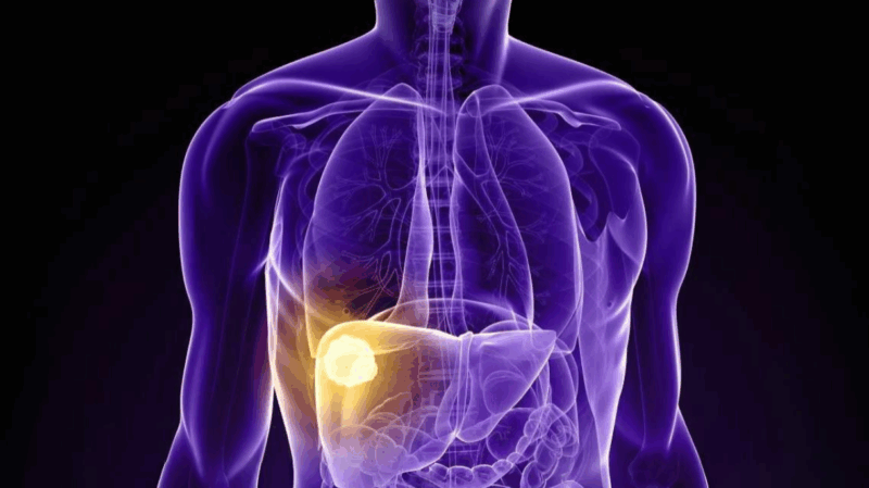UCLA Study Identifies Key Protein that Helps Liver Cancer Resist Heat-Based Treatment