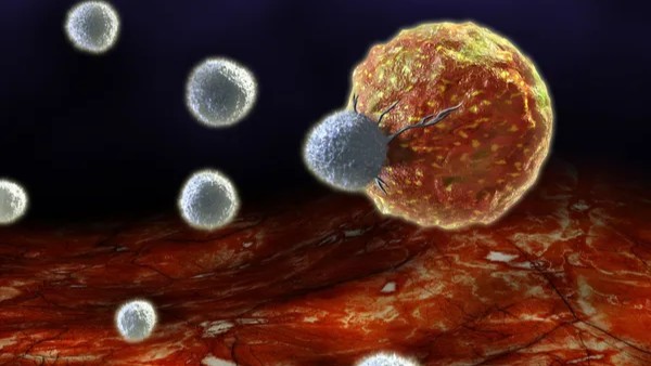 Bassam Sonbol: Randomized Phase II Trial of Pazopanib vs Placebo in Extrapancreatic NETs