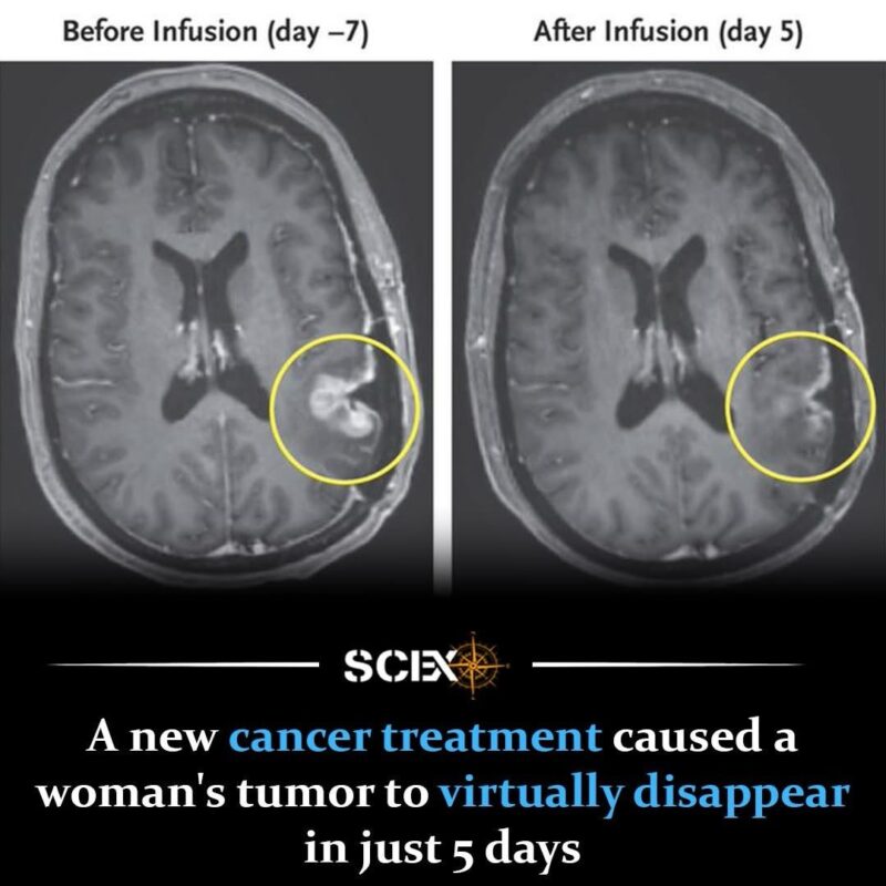 Immuno-Oncology