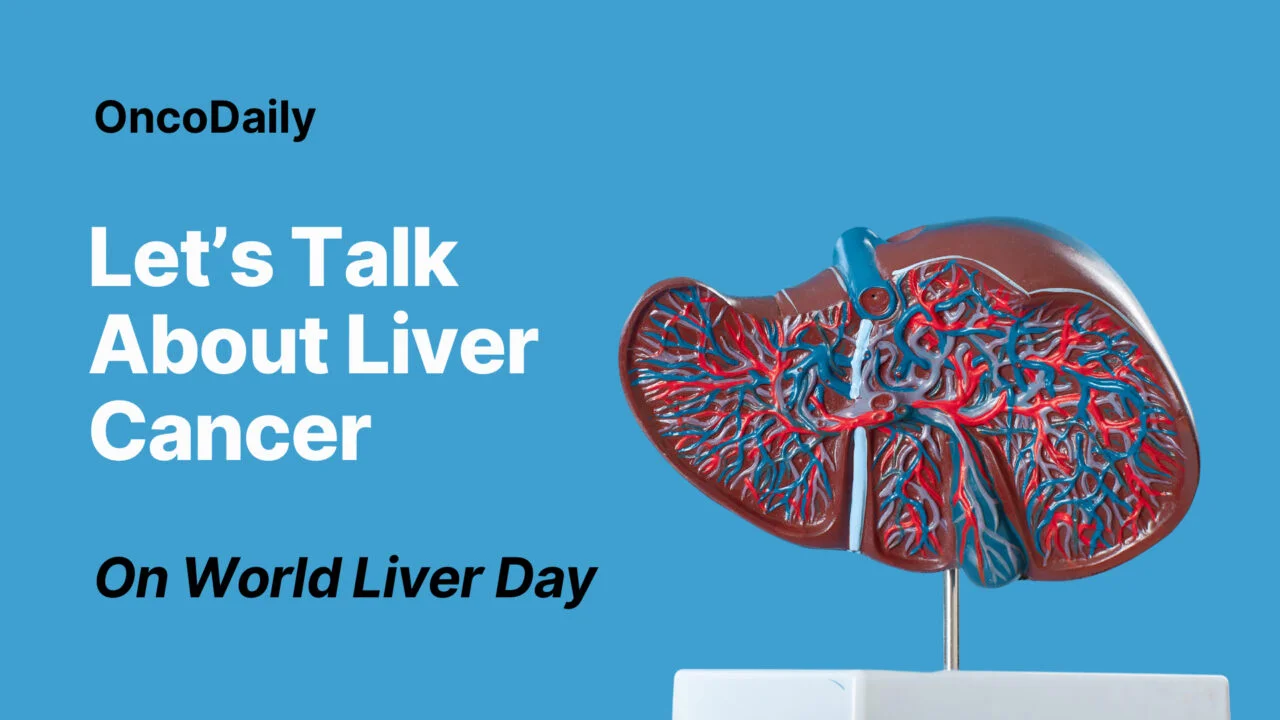 hepatocellular carcinoma