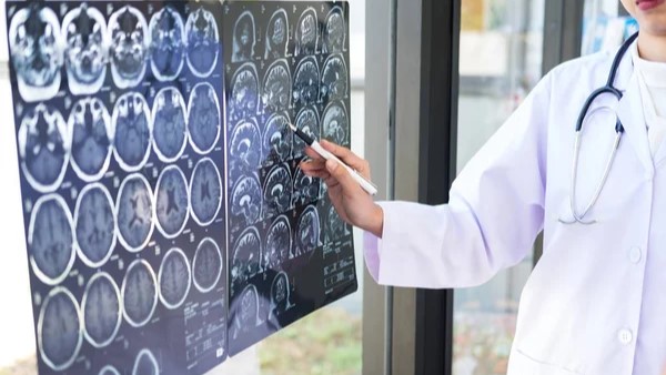Elena Laakmann: The Survey Results on Brain Imaging in Patients with Metastatic Breast Cancer