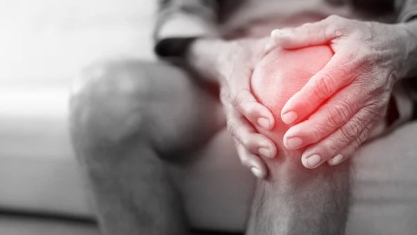 Low-Dose Radiation Therapy May Help Treat Arthritis