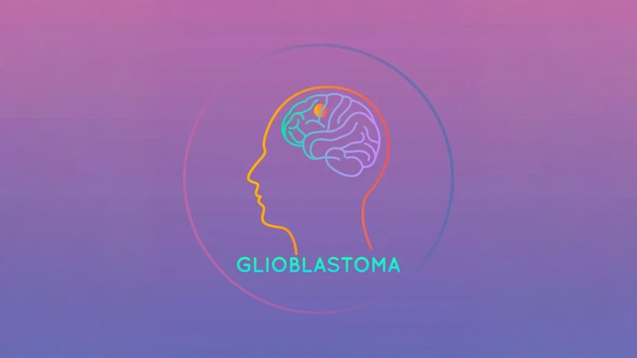 Anthony R. Sloan: Estrogen-Dependent Platelet PAR4 Signaling Shapes Immunity in Glioblastoma