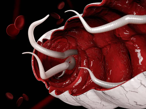 Helminths and Cancer