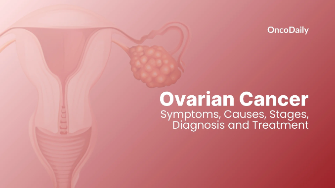 immunotherapy-success-rate-for-ovarian-cancer