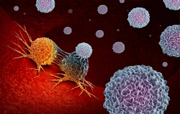 Exosome based cancer therapy