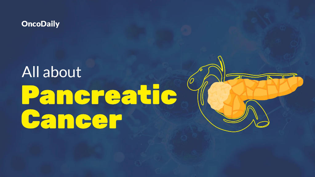 Pancreatic Cancer Cure Rate