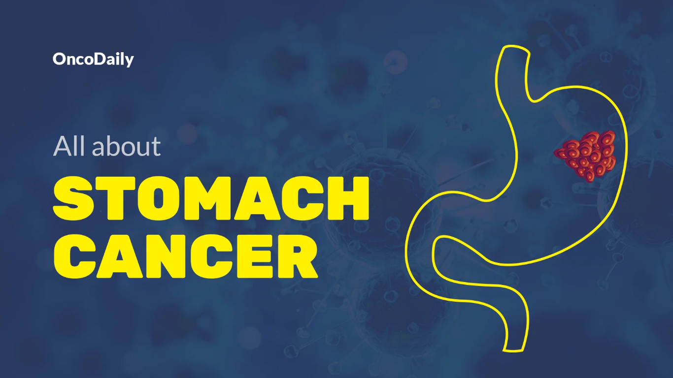 Stomach Cancer Cure Rate