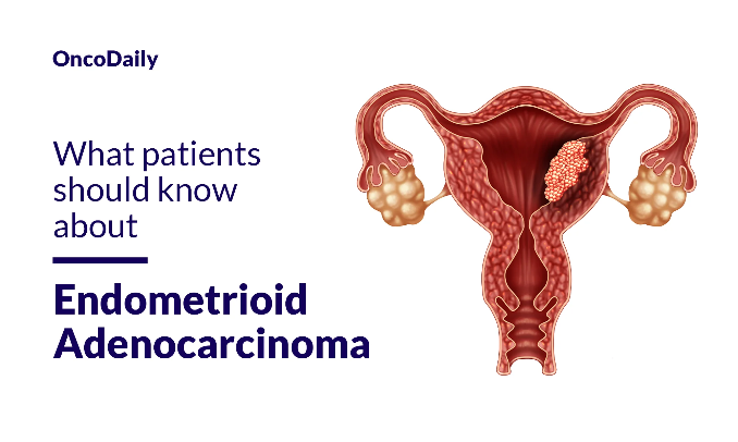 Endometrial Cancer Cure Rate