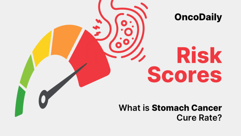 Stomach Cancer Cure Rate: What Patients Need to Know in 2025