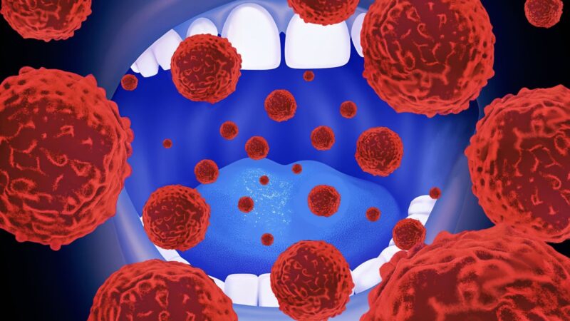 What If a Saliva Sample Could Help Flag Pancreatic Cancer Risk? – CancerWorld
