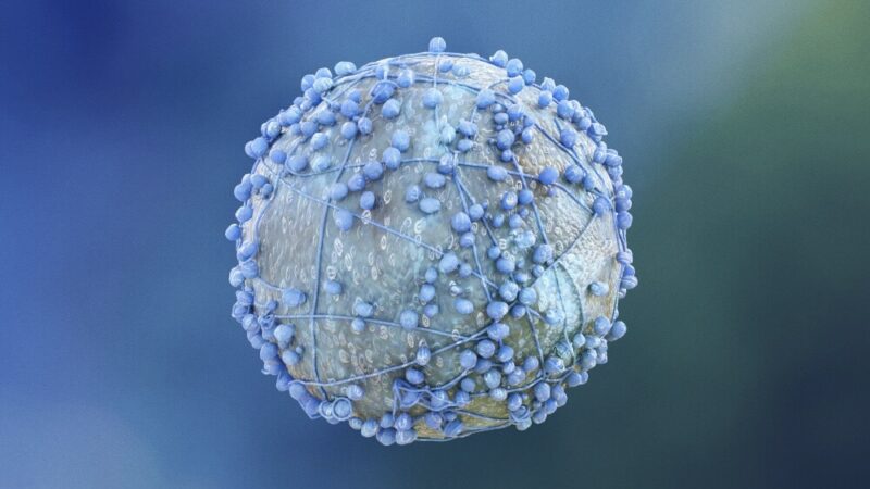 Early Detection, Targeted Therapies, and Immunotherapy Advances in Pancreatic Cancer – Dana-Farber Cancer Institute