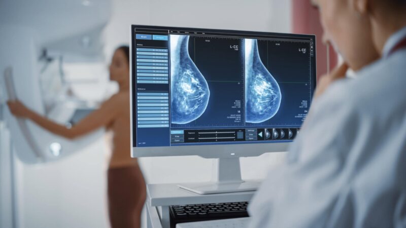 Sahar Mansour: How AI is Changing the Way We Understand Grouped Breast Microcalcifications?